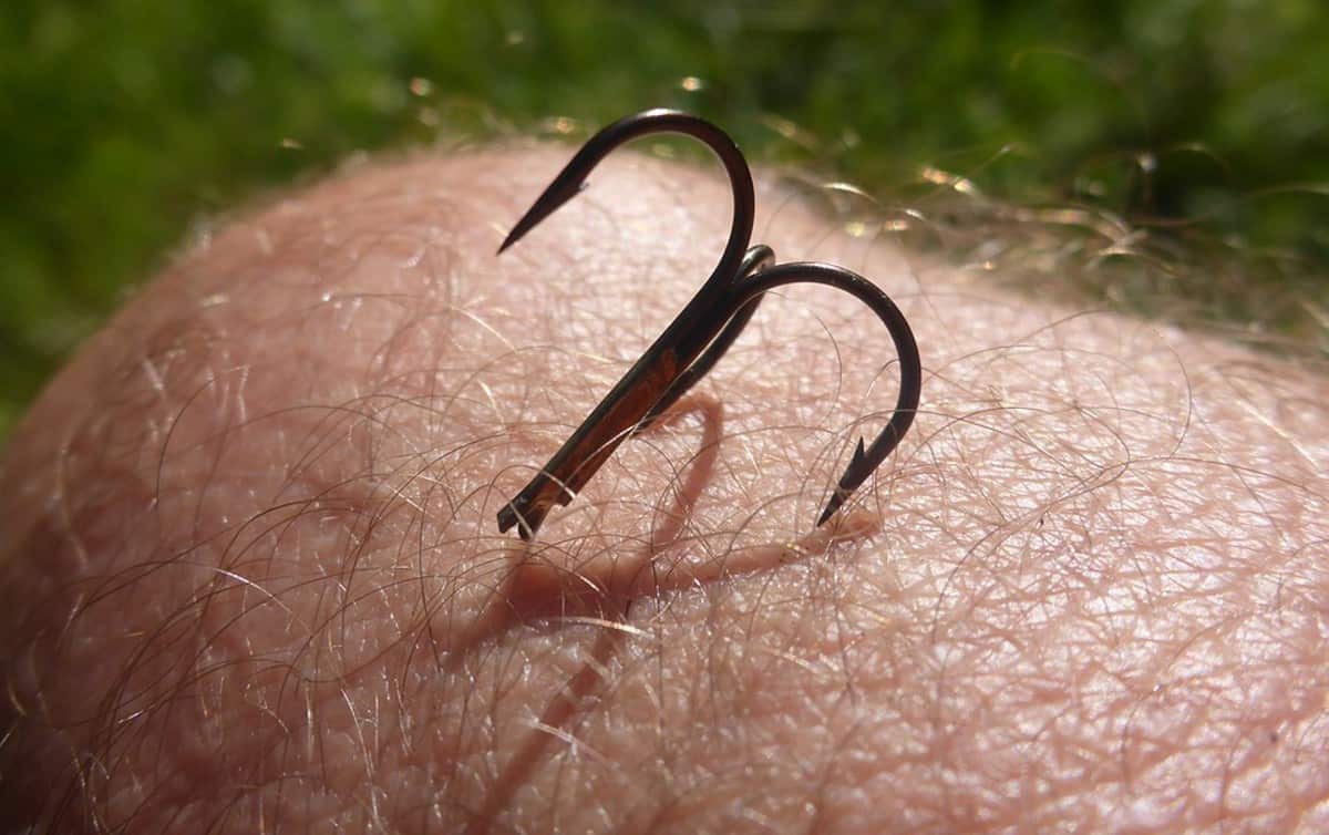 Keep the Right Tools Handy to Remove Fish Hooks From Your Skin